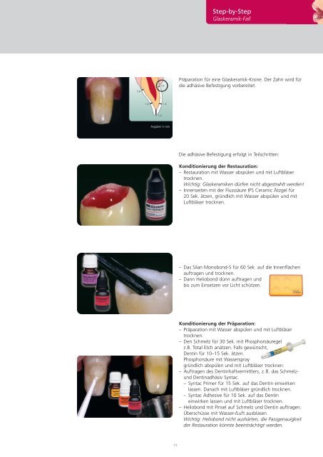 IPS e.max Clinical Guide - Ivoclar Vivadent