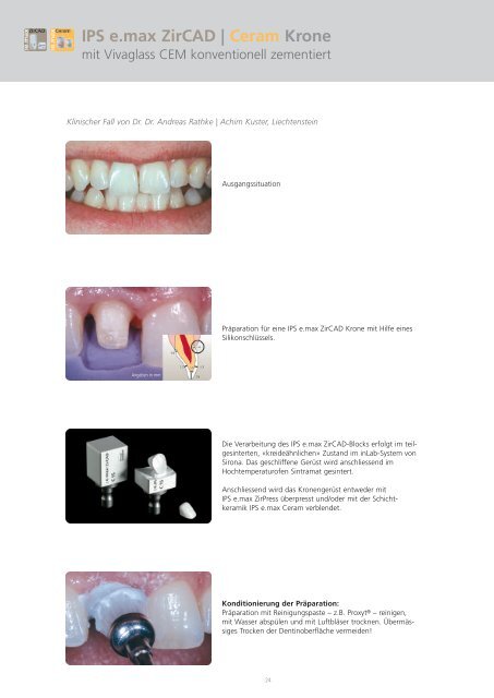 IPS e.max Clinical Guide - Ivoclar Vivadent