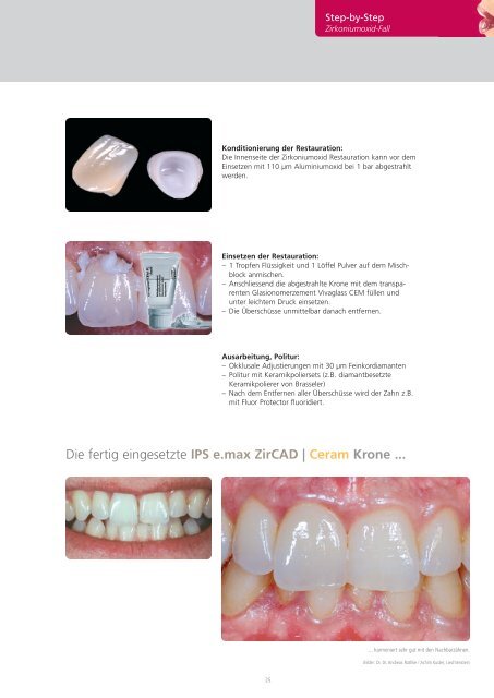 IPS e.max Clinical Guide - Ivoclar Vivadent