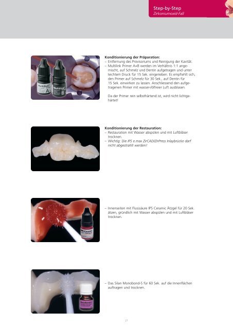 IPS e.max Clinical Guide - Ivoclar Vivadent