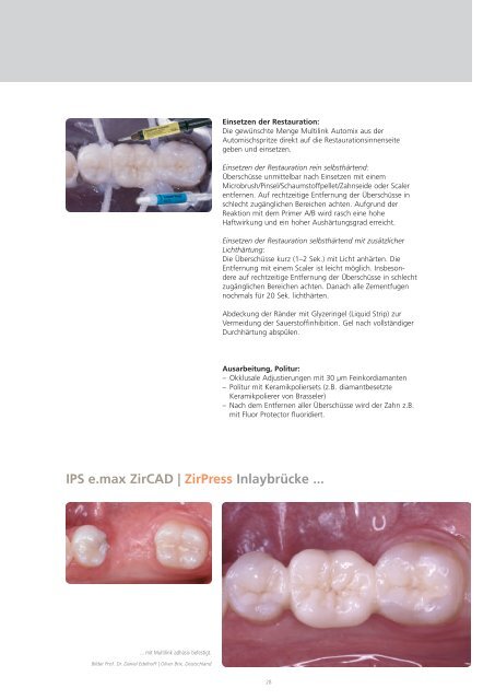 IPS e.max Clinical Guide - Ivoclar Vivadent