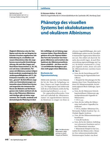 Phänotyp des visuellen Systems bei okulokutanem ... - Albinismus.info