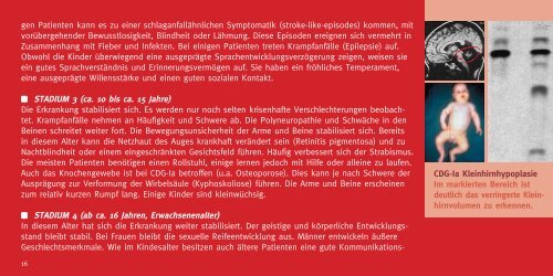 „Eine schmerzliche Wahrheit ist besser als eine Lüge“ - CDG-Syndrom