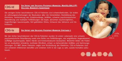 „Eine schmerzliche Wahrheit ist besser als eine Lüge“ - CDG-Syndrom