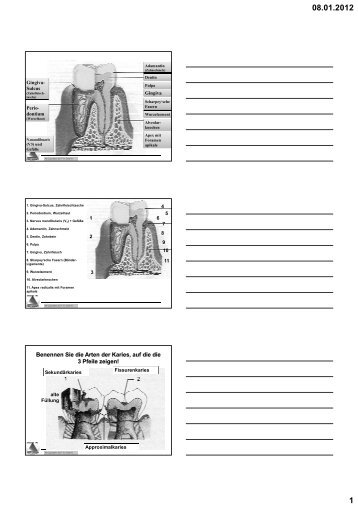 08 Fragenkatalog für Klassenarbeit - Kariologie - zah07.p-a.li