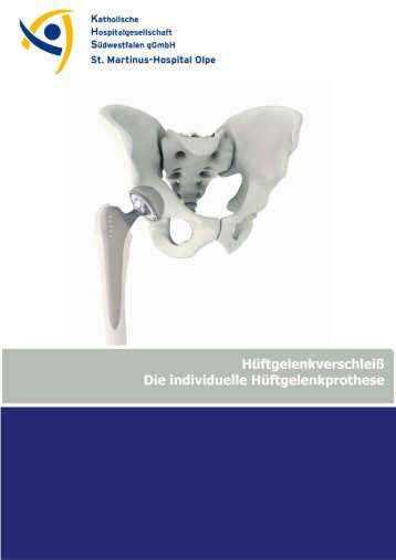 Individueller Hüftgelenkersatz - Katholische Hospitalgesellschaft ...