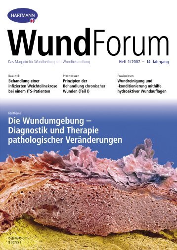 Die Wundumgebung – Diagnostik und Therapie pathologischer ...