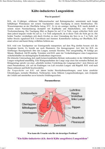 Kälte-induziertes Lungenödem - Dr. med. Hans-Michael Hackenberg