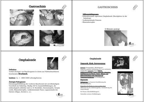 Kinder-Viszeralchirurgie Teil 2 - gastroenterology-hepatology-basel