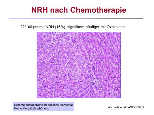 Pathologie Bochum Tumorregression und ... - GI-Oncology