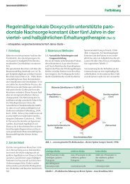 Regelmäßige lokale Doxycyclin unterstützte parodontale Nachsorge ...