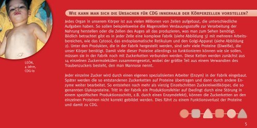 Ein Leitfaden für Ärzte und betroffene Eltern - CDG-Syndrom