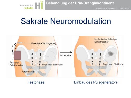 Behandlung der Urin-Dranginkontinenz - Das interdisziplinäre ...