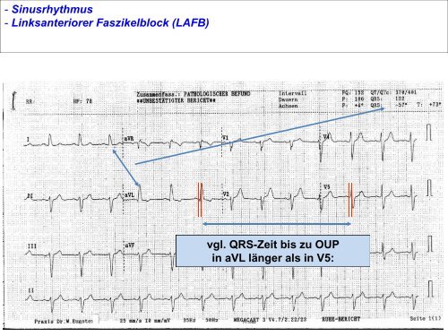 EKG-Quiz - Dr. Werner Eugster - Herzteam Wil