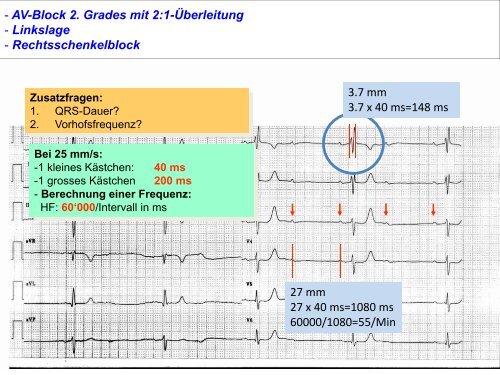 EKG-Quiz - Dr. Werner Eugster - Herzteam Wil