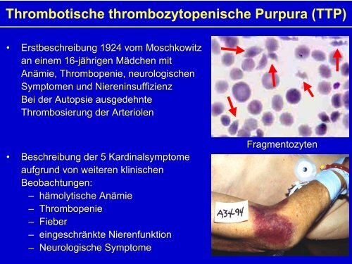 Hämostaseologie II - Hämatologie und Onkologie Rostock