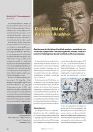 Das neue Bild der Alzheimer-Krankheit - Trillium