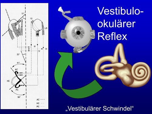 Folien - Klinik für Neurologie