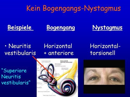 Folien - Klinik für Neurologie