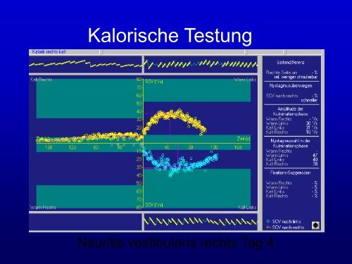 Folien - Klinik für Neurologie