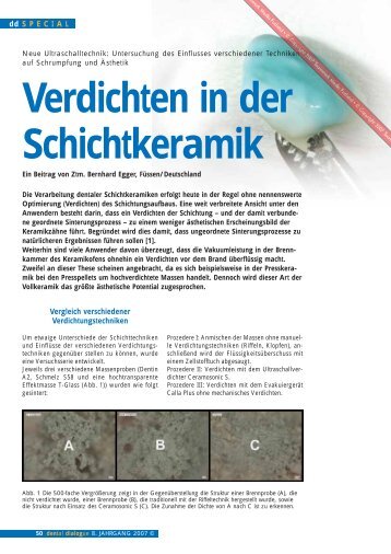 Verdichten in der Schichtkeramik - SHOFU Dental GmbH