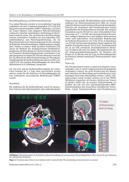 Bestrahlung von Schädelbasistumoren mit Kohlenstoffionen bei der ...