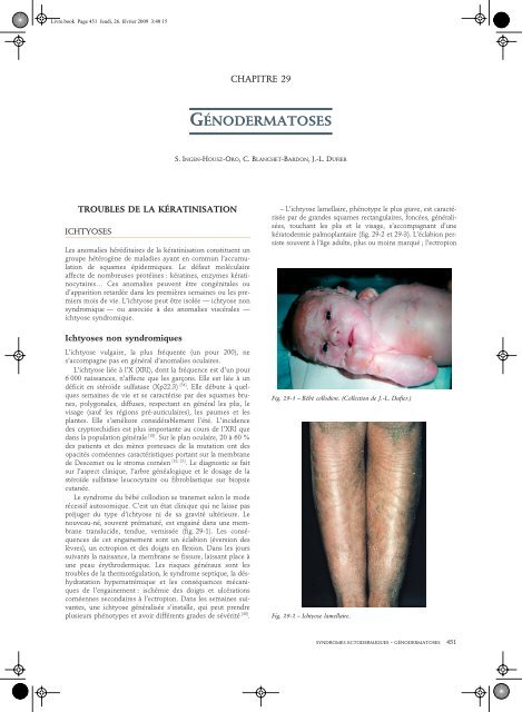 Lire L Article Retinavision Fr Lire L Article Retinavision Fr