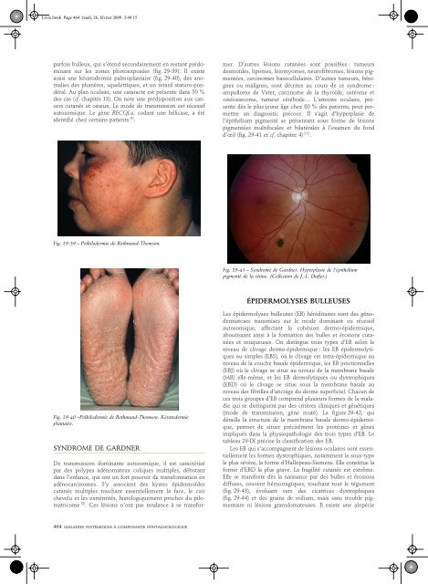 Lire l'Article - retinavision.fr