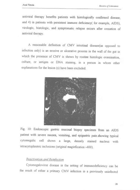 A CLINICO.PATHOLOGICAL STUDY OF ANAL FISTULAE