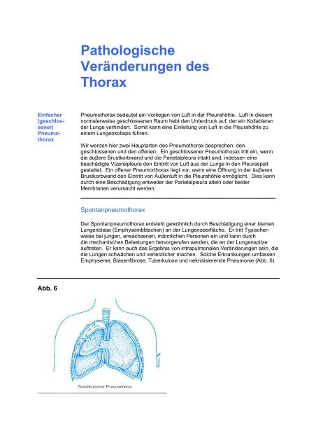 Thoraxdrainage richtig verstehen - Bak-24.de