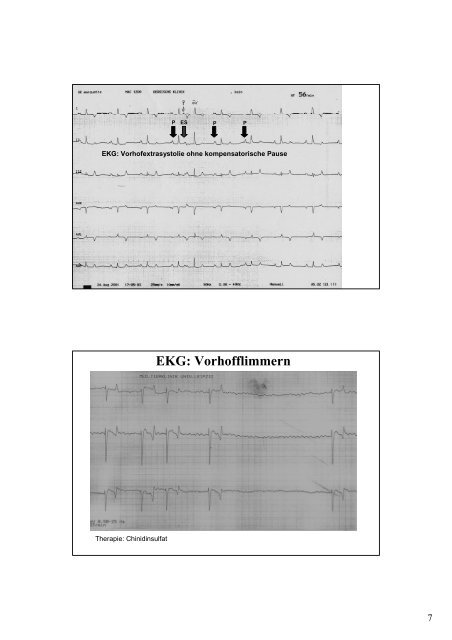 7_8 Kardiologie, Kollaps, plötzlicher Tod