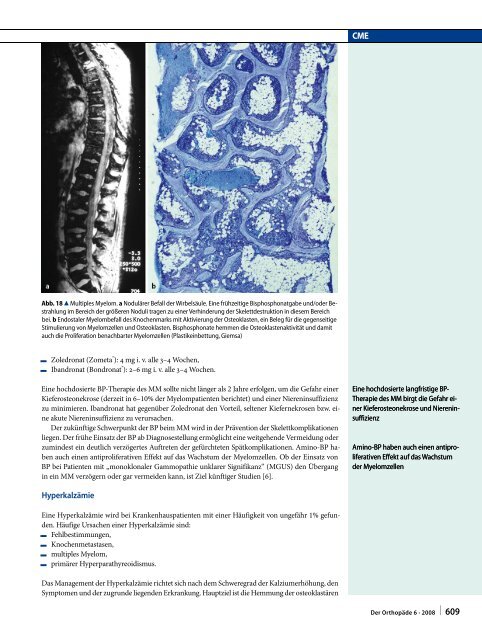 Einsatz der Bisphosphonate in der Orthopädie und Unfallchirurgie