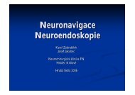 Neuronavigace, neuroendoskopie - Hrubá Skála - symposia