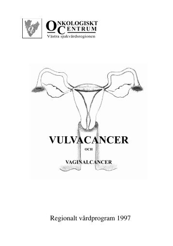 Vulvacancer och vaginalcancer