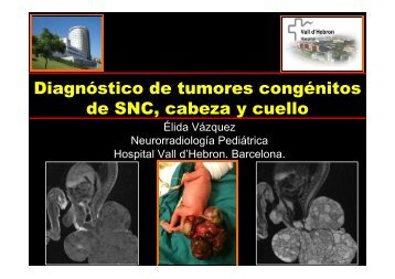 Diagnostico Tumores Congenitos SNC, Cabeza y Cuello - Geyseco