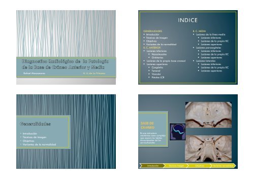 16. Patologia base craneo anterior y media copia.pptx - Geyseco