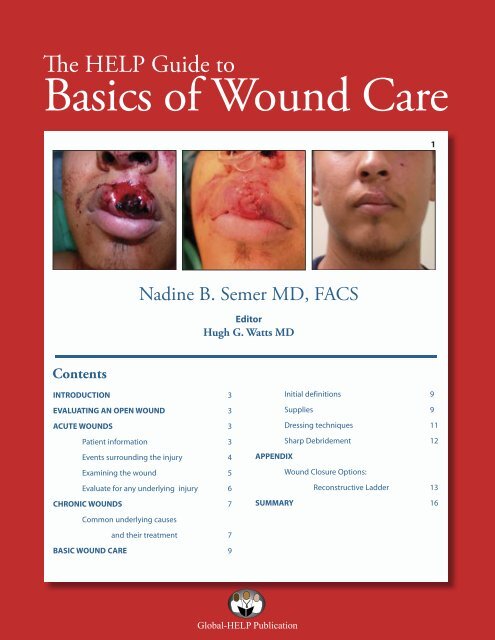 Basics of Wound Care - GHDonline