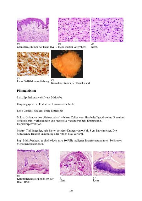 1. Einführung in die Pathologie - Wikimedia