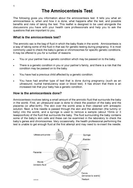 The Amniocentesis Test - Genetic Alliance UK