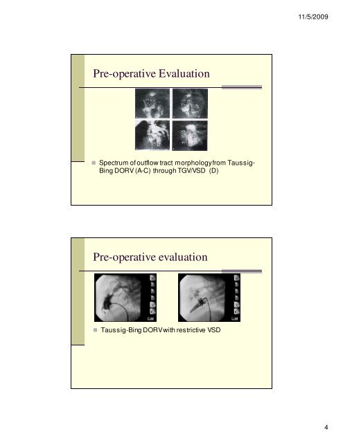 Angiography and Intervention in TGV