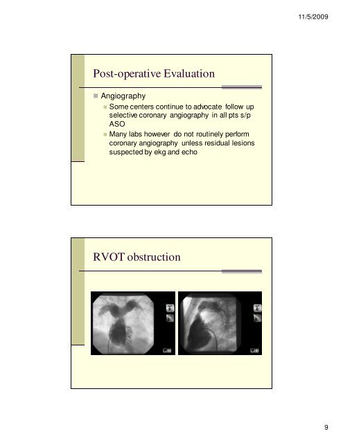 Angiography and Intervention in TGV