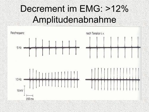 Folien - Klinik für Neurologie - Universität zu Lübeck