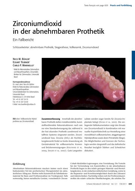 Zirconiumdioxid in der abnehmbaren Prothetik - Zirkonzahn