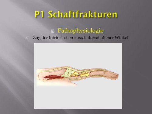 Frakturen des Handskelettes (PDF, 5.6MB)