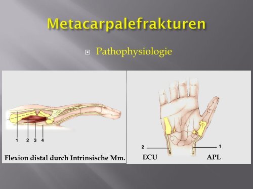 Frakturen des Handskelettes (PDF, 5.6MB)