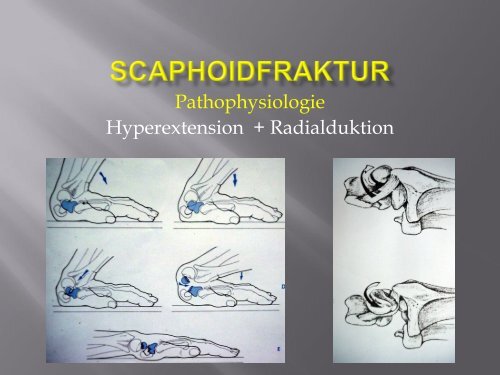 Frakturen des Handskelettes (PDF, 5.6MB)