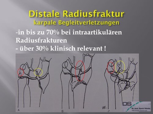 Frakturen des Handskelettes (PDF, 5.6MB)