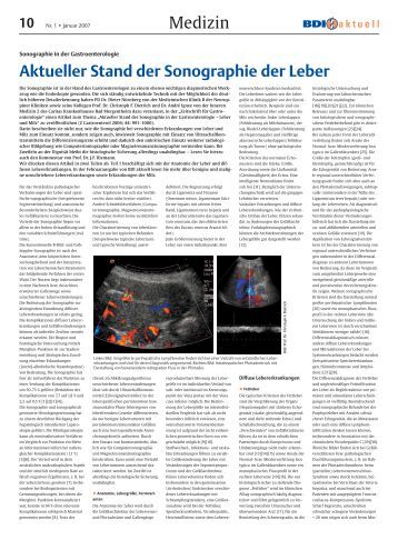 read h2 blocker in der therapie