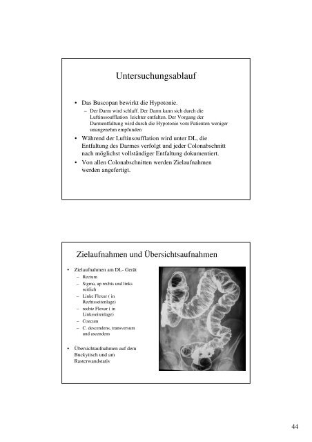 Kontrastmitteluntersuchungen - MTA-Schule Ludwigshafen