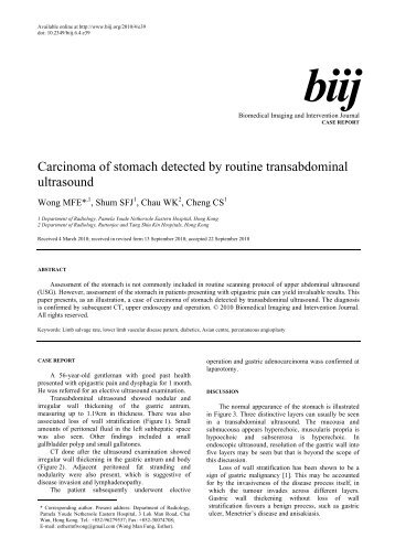 Carcinoma of stomach detected by routine transabdominal ultrasound